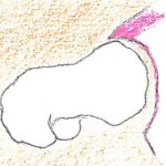 pincer